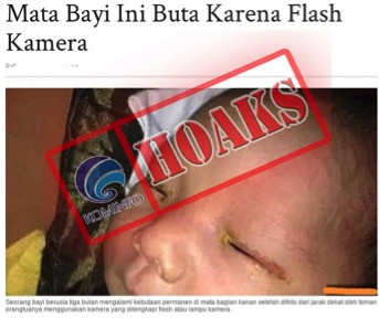 [HOAKS] Seorang Bayi di Tiongkok Mengalami Kebutaan Akibat Flash Kamera