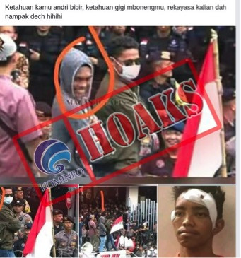 [HOAKS] Penangkapan dan Pengakuan Andri Bibir Hanya Rekayasa Polisi