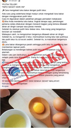 [HOAKS] Putih Telur Dapat Mengobati Luka Bakar